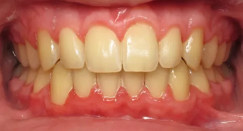 After - Patient smile transformation 1