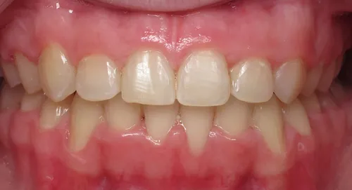 After - Patient smile transformation 3