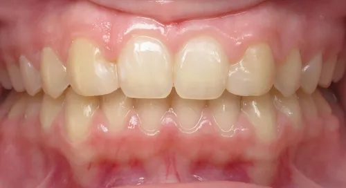 After - Patient smile transformation 6