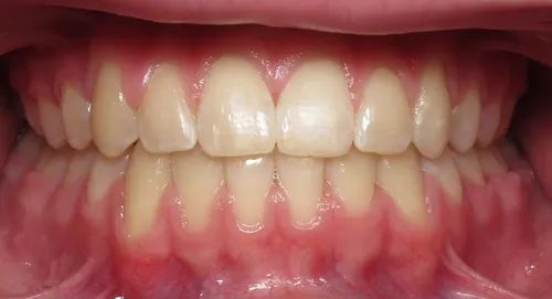 After - Patient smile transformation 7