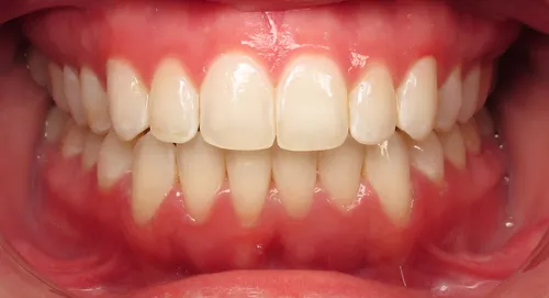 After - Patient smile transformation 8