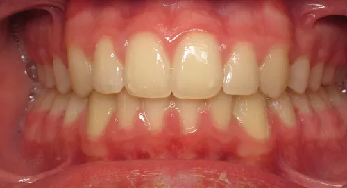 After - Patient smile transformation 9