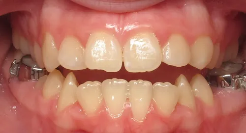 Before - Patient smile transformation 3