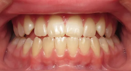 Before - Patient smile transformation 7