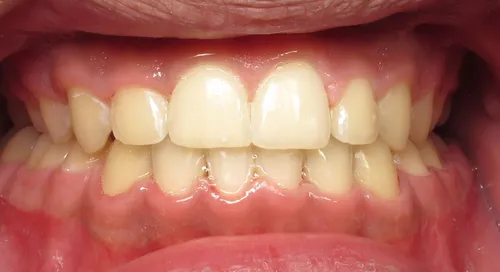 After - Patient smile transformation 10